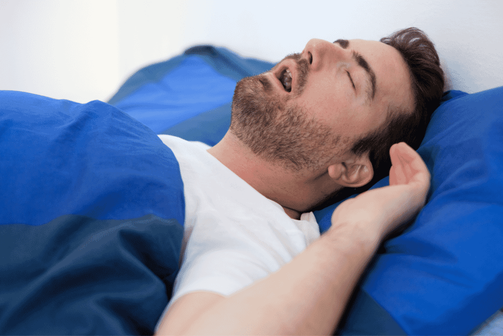 how to treat mild sleep apnea