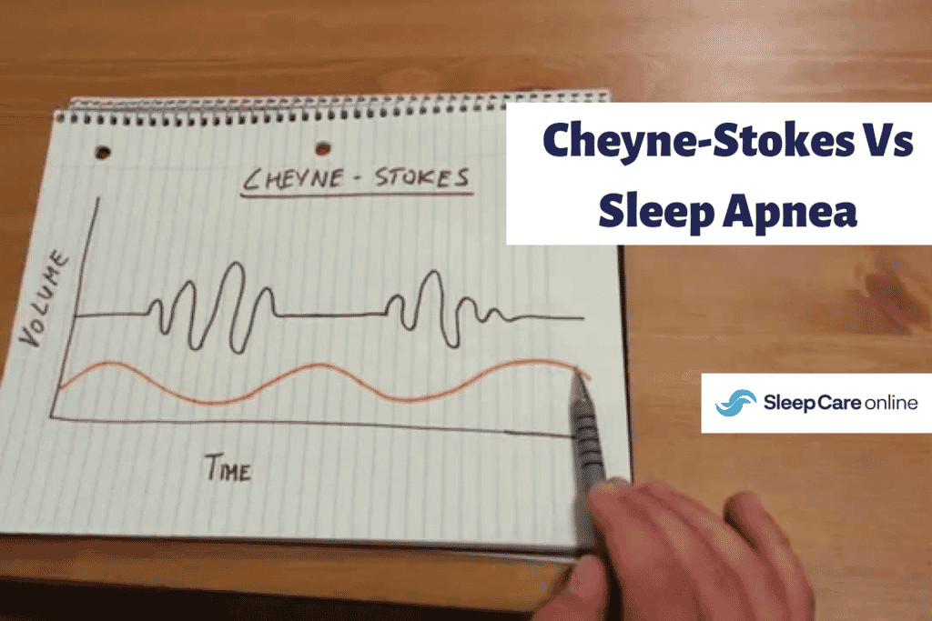 Cheyne Scale Questionnaire Cheyne-Stokes Vs Sleep Apnea: The Difference | Sleep Care